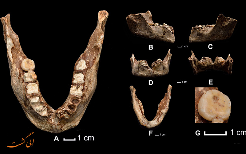 استخوان انسان پیدا شده در لائوس