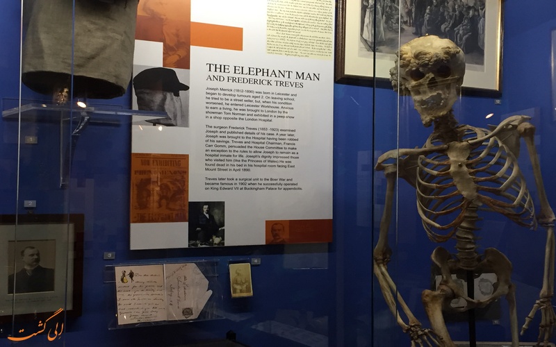 یادبود مرد فیلی در موزه بیمارستان